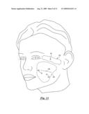 Surgical suturing device, method and tools used therewith diagram and image