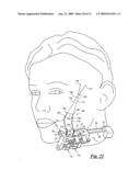 Surgical suturing device, method and tools used therewith diagram and image