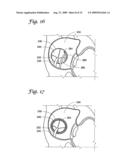 IMPLANTABLE CLOSURE APPARATUS AND METHODS diagram and image