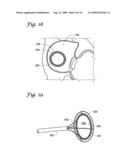 IMPLANTABLE CLOSURE APPARATUS AND METHODS diagram and image