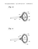 IMPLANTABLE CLOSURE APPARATUS AND METHODS diagram and image