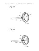 IMPLANTABLE CLOSURE APPARATUS AND METHODS diagram and image