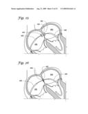 IMPLANTABLE CLOSURE APPARATUS AND METHODS diagram and image