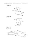 IMPLANTABLE CLOSURE APPARATUS AND METHODS diagram and image