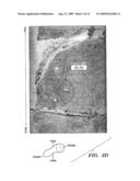 FEEDBACK METHOD FOR DEEP BRAIN STIMULATION WITH DETECTION OF GENERALIZED EFFERENCE COPY SIGNALS diagram and image