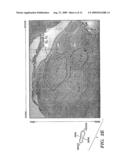 FEEDBACK METHOD FOR DEEP BRAIN STIMULATION WITH DETECTION OF GENERALIZED EFFERENCE COPY SIGNALS diagram and image