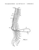 TEMPORARY NEUROSTIMULATION LEAD IDENTIFICATION DEVICE diagram and image