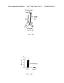 Magnetic Gradient Targeting And Sequestering Of Therapeutic Formulations And Therapeutic Systems Thereof diagram and image