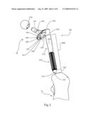 Femoral Hip Prosthesis and Method of Implantation diagram and image