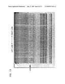 Genetic marker linked to gene locus involved in barley resistance to yellow mosaic disease and use thereof diagram and image