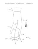 Gas discharge device for a vehicle engine diagram and image