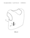 Resilient shock-absorbing device diagram and image