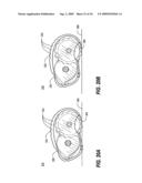 SPOOLED ADHESIVE BANDAGE DISPENSER diagram and image