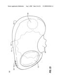 SPOOLED ADHESIVE BANDAGE DISPENSER diagram and image