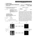 METHOD FOR PROCESSING IMAGES OF INTERVENTIONAL RADIOLOGY diagram and image