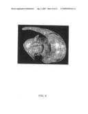 Image Guidance System for Deep Brain Stimulation diagram and image