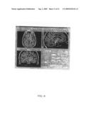 Image Guidance System for Deep Brain Stimulation diagram and image