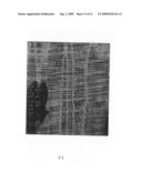 Image Guidance System for Deep Brain Stimulation diagram and image