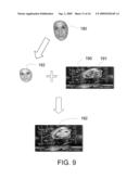 METHOD, A SYSTEM, AND A COMPUTER PROGRAM PRODUCT FOR PROCESSING IMAGES diagram and image