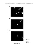 VERY SMALL EMBRYONIC-LIKE (VSEL) STEM CELLS AND METHODS OF ISOLATING AND USING THE SAME diagram and image