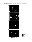 VERY SMALL EMBRYONIC-LIKE (VSEL) STEM CELLS AND METHODS OF ISOLATING AND USING THE SAME diagram and image