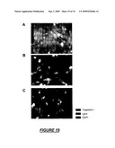 VERY SMALL EMBRYONIC-LIKE (VSEL) STEM CELLS AND METHODS OF ISOLATING AND USING THE SAME diagram and image