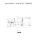 VERY SMALL EMBRYONIC-LIKE (VSEL) STEM CELLS AND METHODS OF ISOLATING AND USING THE SAME diagram and image