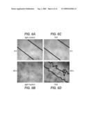 COMBINATORIAL THERAPY diagram and image