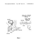 METHODS FOR TREATING A STRICTURE WITH A BOTULINUM TOXIN diagram and image