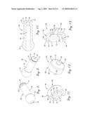 Injection Molding Apparatus with Replaceable Gate Insert diagram and image