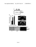 METHODS FOR DIAGNOSING AND TREATING CANCERS VIA MANIPULATIONS OF A...PATHWAY diagram and image