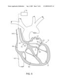 PRECISION CONTROL SYSTEMS FOR TISSUE VISUALIZATION AND MANIPULATION ASSEMBLIES diagram and image