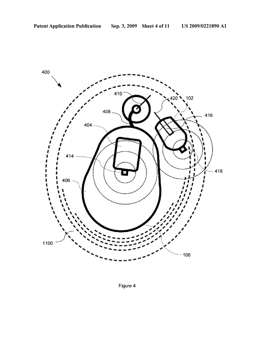 Diabetes Management System - diagram, schematic, and image 05