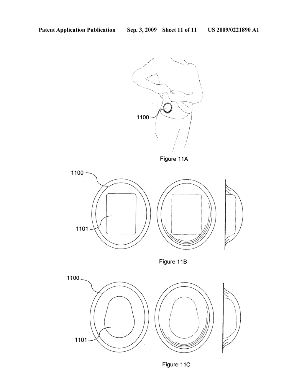 Diabetes Management System - diagram, schematic, and image 12