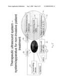 Ultrasound Treatment Center diagram and image