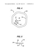 INTRALUMINAL TISSUE MARKERS diagram and image