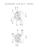 System and method for detection of hematoma diagram and image