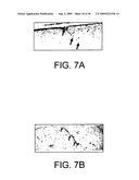 LOW-COHERENCE INTERFEROMETRY AND OPTICAL COHERENCE TOMOGRAPHY FOR IMAGE-GUIDED SURGICAL TREATMENT OF SOLID TUMORS diagram and image