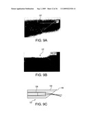 LOW-COHERENCE INTERFEROMETRY AND OPTICAL COHERENCE TOMOGRAPHY FOR IMAGE-GUIDED SURGICAL TREATMENT OF SOLID TUMORS diagram and image