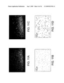 LOW-COHERENCE INTERFEROMETRY AND OPTICAL COHERENCE TOMOGRAPHY FOR IMAGE-GUIDED SURGICAL TREATMENT OF SOLID TUMORS diagram and image