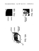 LOW-COHERENCE INTERFEROMETRY AND OPTICAL COHERENCE TOMOGRAPHY FOR IMAGE-GUIDED SURGICAL TREATMENT OF SOLID TUMORS diagram and image