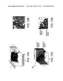 LOW-COHERENCE INTERFEROMETRY AND OPTICAL COHERENCE TOMOGRAPHY FOR IMAGE-GUIDED SURGICAL TREATMENT OF SOLID TUMORS diagram and image