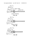 METHODS AND DEVICES FOR IN SITU TISSUE NAVIGATION diagram and image