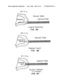 METHODS AND DEVICES FOR IN SITU TISSUE NAVIGATION diagram and image