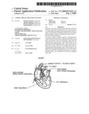 Cardiac Disease Treatment System diagram and image