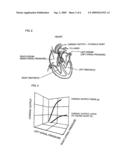 Cardiac Disease Treatment System diagram and image