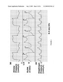 Method and Device for Generating of a Signal that Reflects Respiratory Efforts in Patients on Ventilatory Support diagram and image