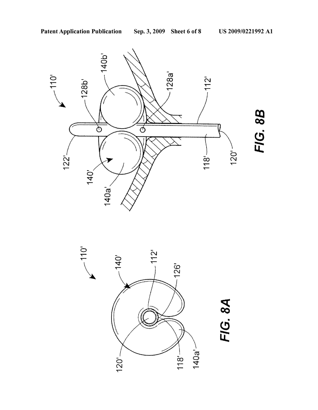 Fluid Drainage Catheter Having an External Flow Path - diagram, schematic, and image 07