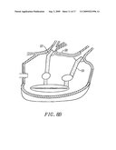 CIRCUMFERENTIAL ABLATION DEVICE ASSEMBLY diagram and image