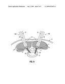 Minimally Invasive Retractor and Methods of Use diagram and image